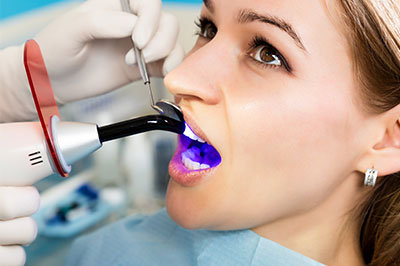 This is an image of a woman receiving dental care, sitting in a dental chair with a dental hygienist using a device to clean her teeth, while wearing a blue mouthguard and having a purple dye applied to her teeth for a cleaning process.