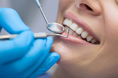 A dental professional is performing a teeth cleaning procedure on a patient s mouth using specialized tools.