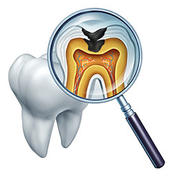 The image shows a magnified view of a tooth with an open crown, revealing the interior structure including the pulp chamber, dentin layers, and root canal system. A dental probe is inserted into the cavity of the tooth, and there s a close-up view of the tooth s interior, highlighting its anatomical features.