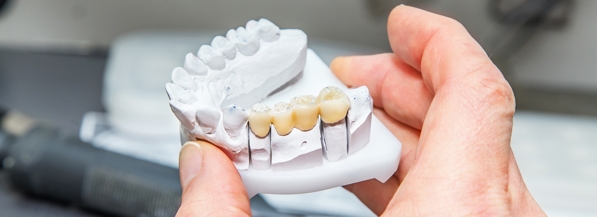 The image shows a person holding a tooth-shaped object with multiple teeth visible on a white background.