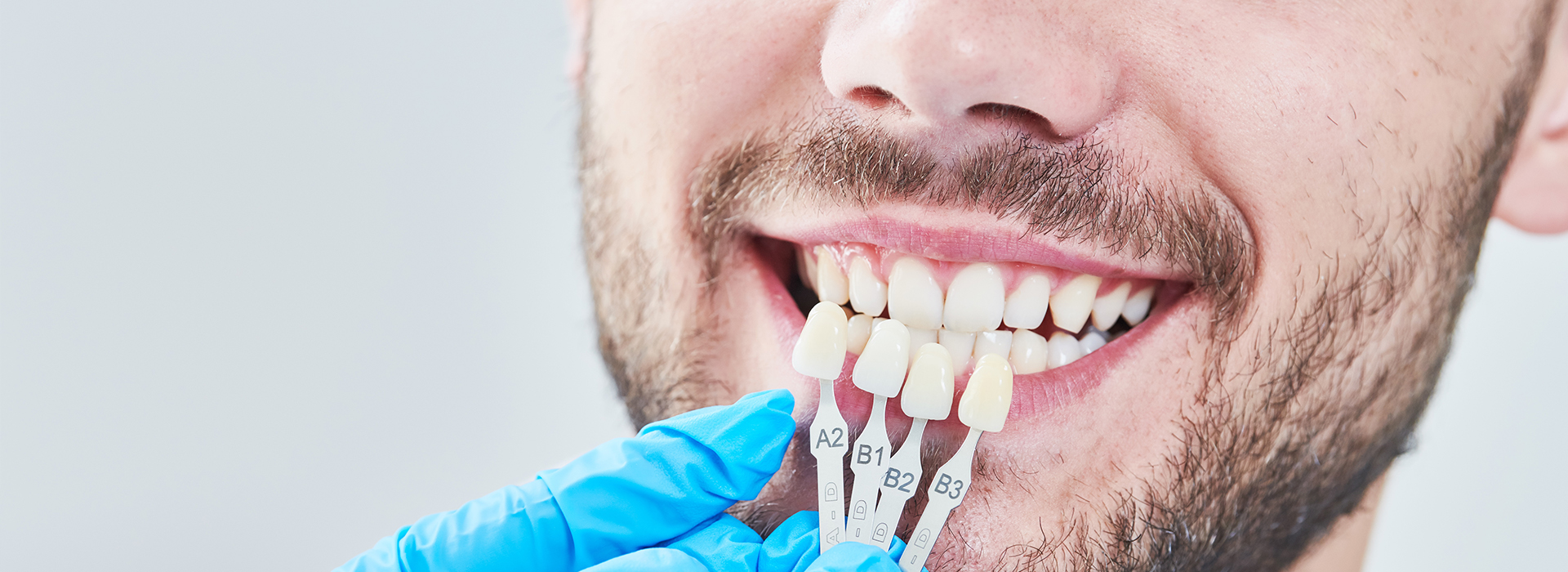 The image shows a man with a toothy smile undergoing dental treatment, with his mouth open and dental tools visible, while he wears blue gloves and has a microscope focused on his teeth.